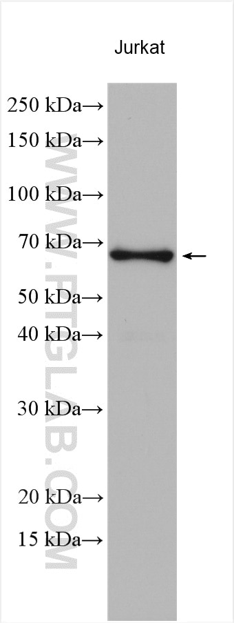 Western Blot (WB) analysis of various lysates using EIF2AK2, PKR Polyclonal antibody (18244-1-AP)