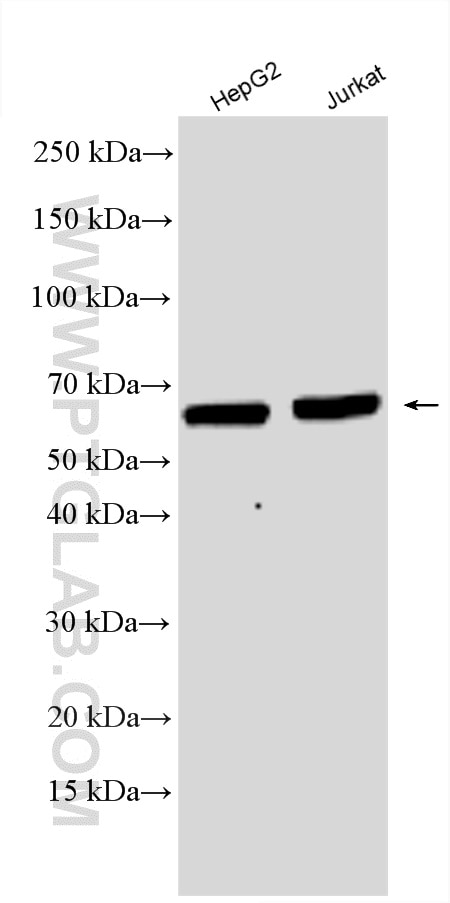 Western Blot (WB) analysis of various lysates using EIF2AK2, PKR Polyclonal antibody (18244-1-AP)