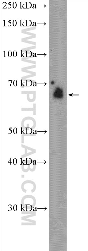Western Blot (WB) analysis of rat heart tissue using EIF2AK2, PKR Polyclonal antibody (18244-1-AP)
