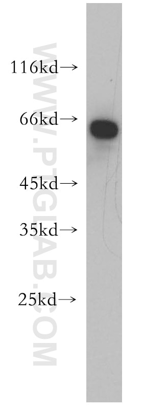 Western Blot (WB) analysis of HeLa cells using EIF2AK2, PKR Polyclonal antibody (18244-1-AP)