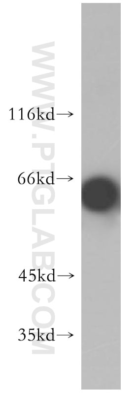 EIF2AK2, PKR Polyclonal antibody