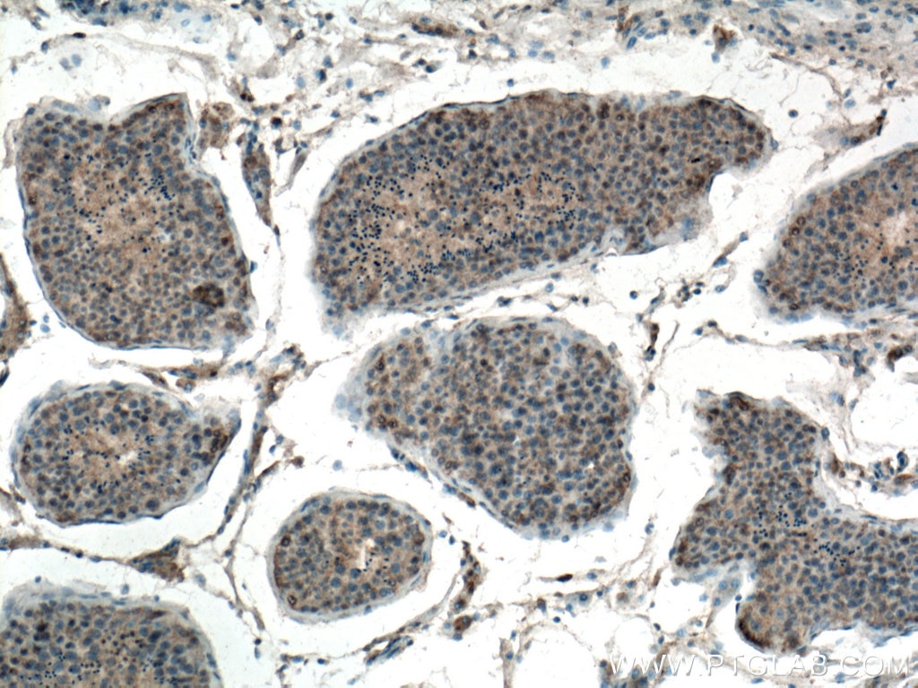 Immunohistochemistry (IHC) staining of human testis tissue using EIF2AK2 Monoclonal antibody (66646-1-Ig)