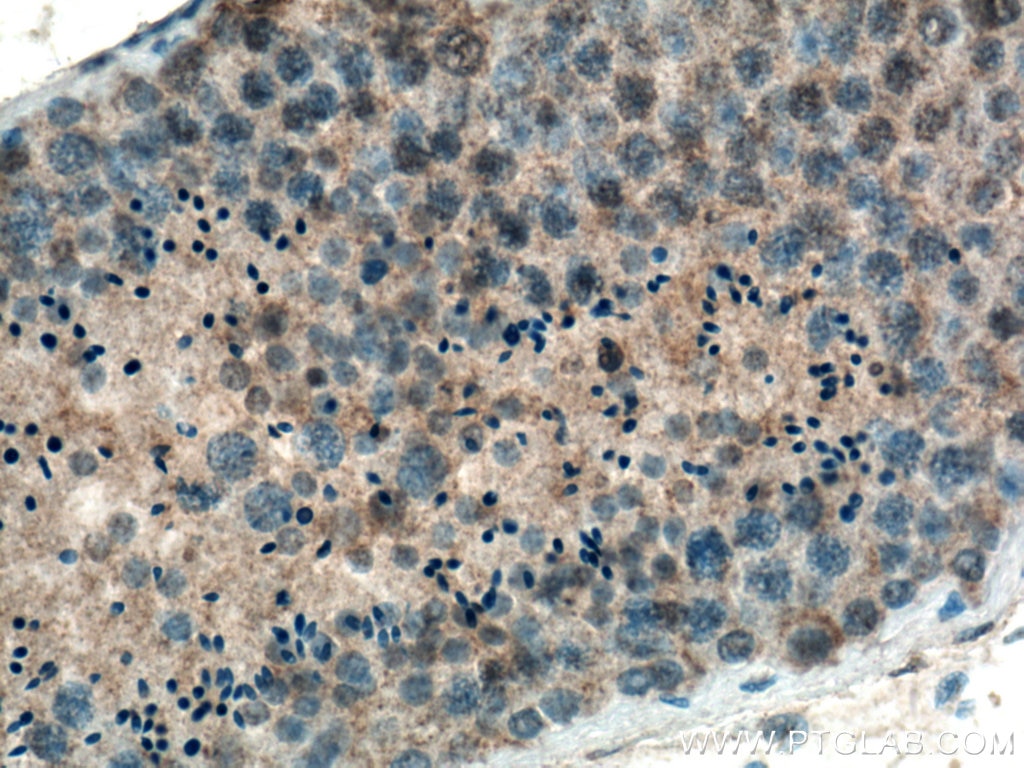 IHC staining of human testis using 66646-1-Ig