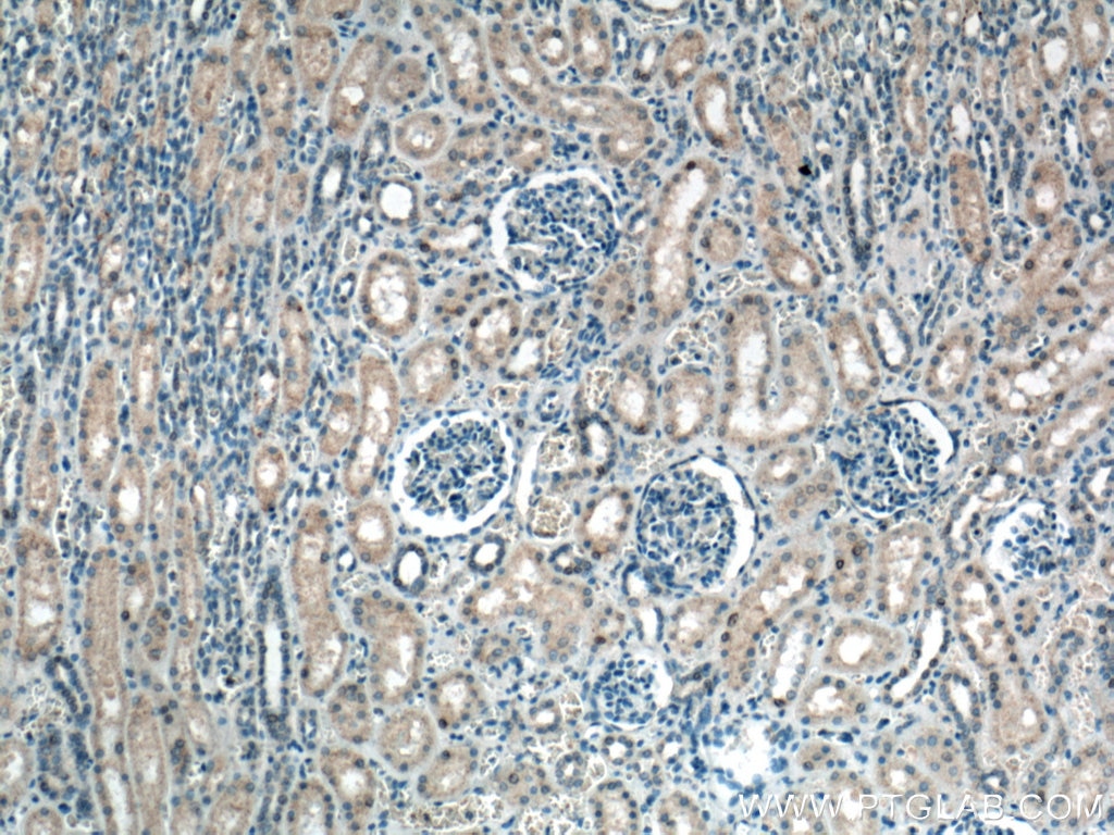 Immunohistochemistry (IHC) staining of human kidney tissue using EIF2AK2 Monoclonal antibody (66646-1-Ig)