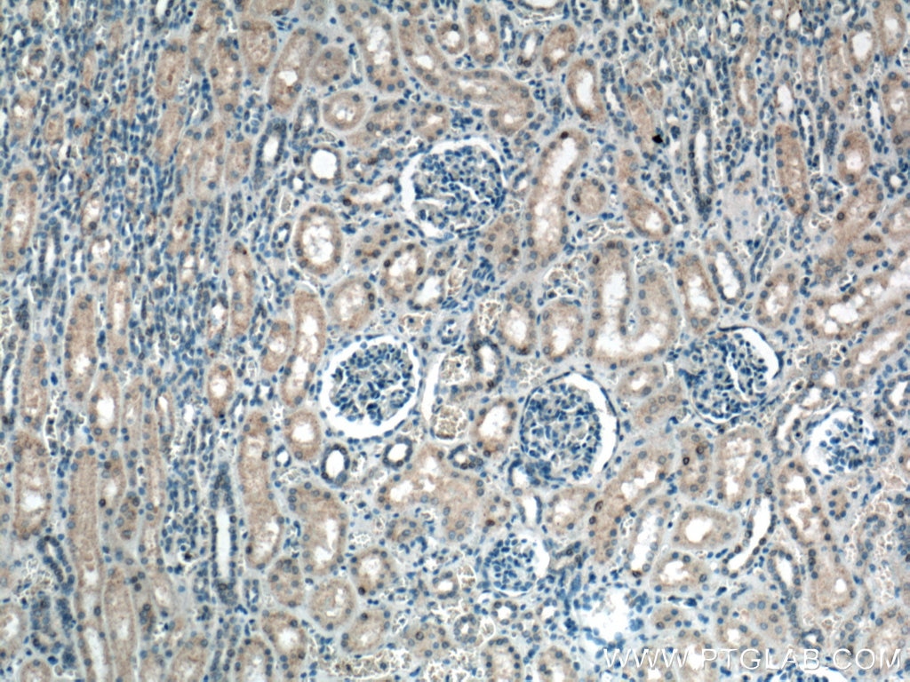 IHC staining of human kidney using 66646-1-Ig