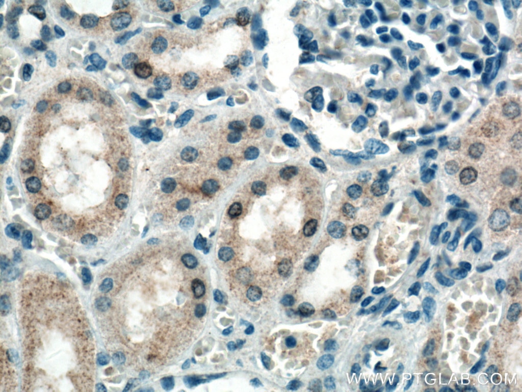 Immunohistochemistry (IHC) staining of human kidney tissue using EIF2AK2 Monoclonal antibody (66646-1-Ig)