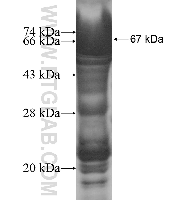 EIF2AK2 fusion protein Ag13010 SDS-PAGE