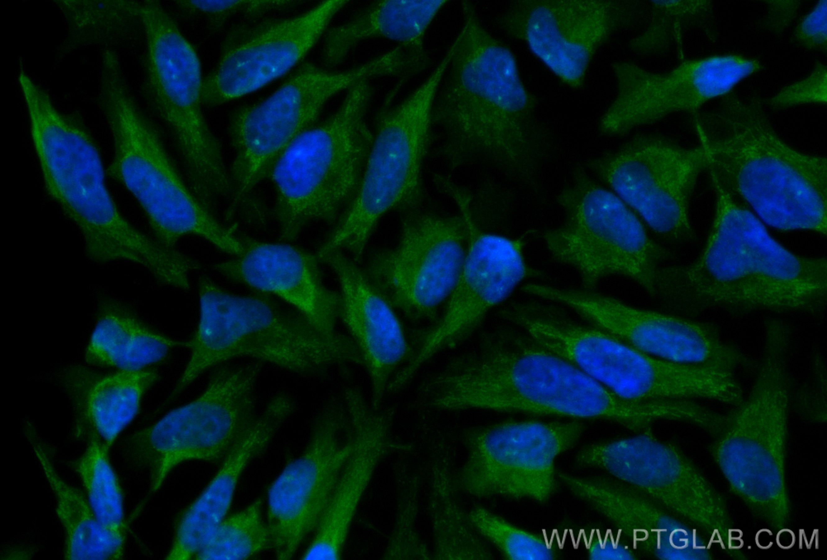 Immunofluorescence (IF) / fluorescent staining of HeLa cells using CoraLite® Plus 488-conjugated EIF2AK2, PKR Polyclo (CL488-18244)