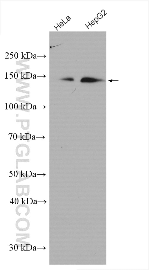 Western Blot (WB) analysis of various lysates using PERK/EIF2AK3 Polyclonal antibody (24390-1-AP)