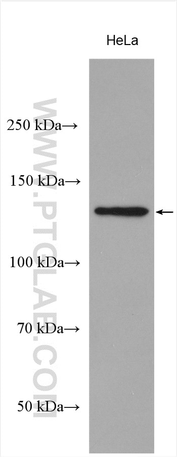 Western Blot (WB) analysis of various lysates using PERK/EIF2AK3 Polyclonal antibody (24390-1-AP)