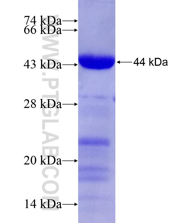 EIF2AK3 fusion protein Ag18254 SDS-PAGE