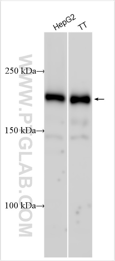 Western Blot (WB) analysis of various lysates using EIF2AK4 Polyclonal antibody (27944-1-AP)