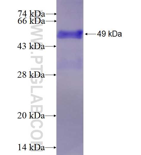 EIF2AK4 fusion protein Ag27617 SDS-PAGE