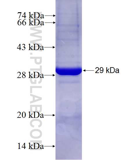 EIF2AK4 fusion protein Ag27629 SDS-PAGE