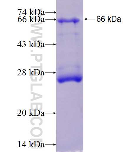 EIF2AK4 fusion protein Ag1654 SDS-PAGE