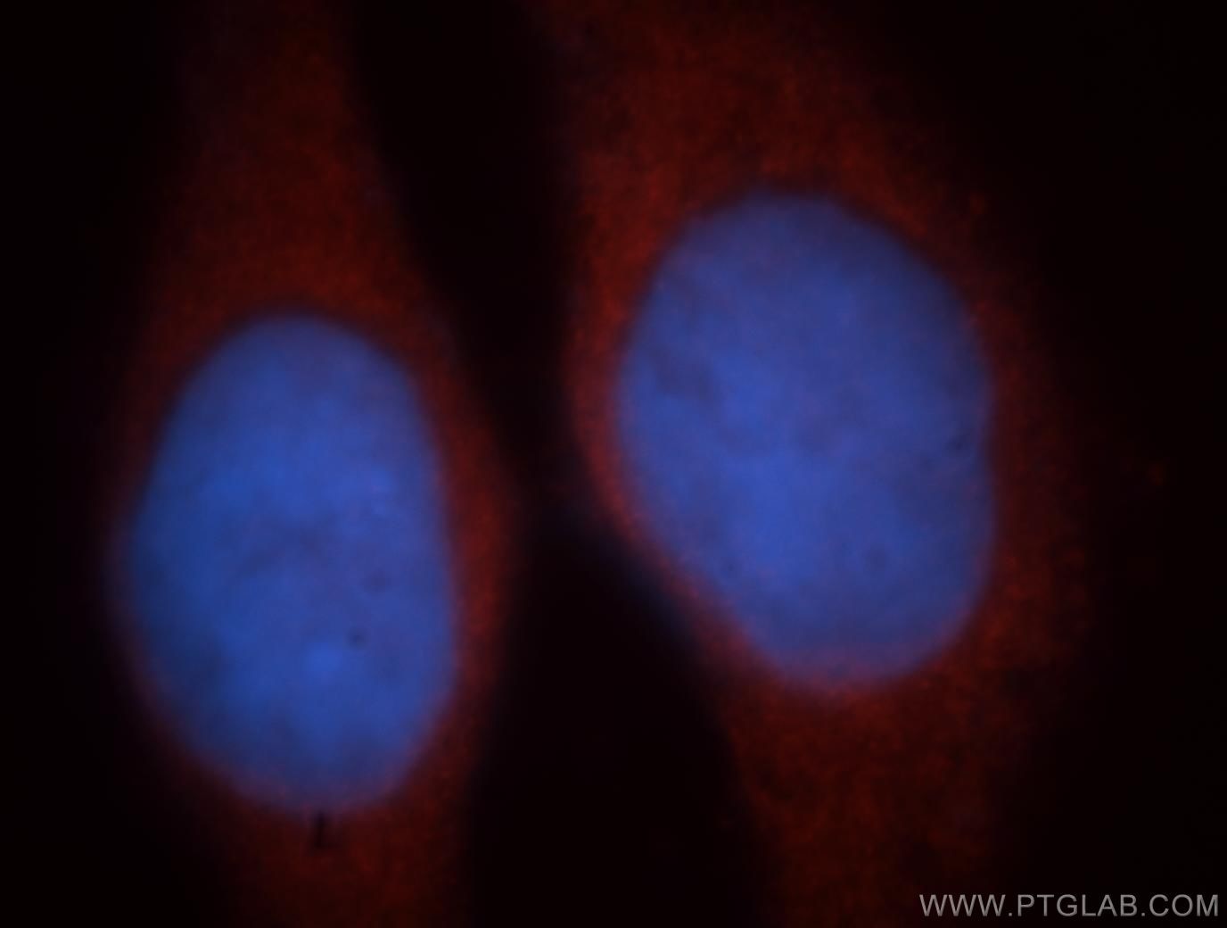 Immunofluorescence (IF) / fluorescent staining of HeLa cells using EIF2B1 Polyclonal antibody (18010-1-AP)