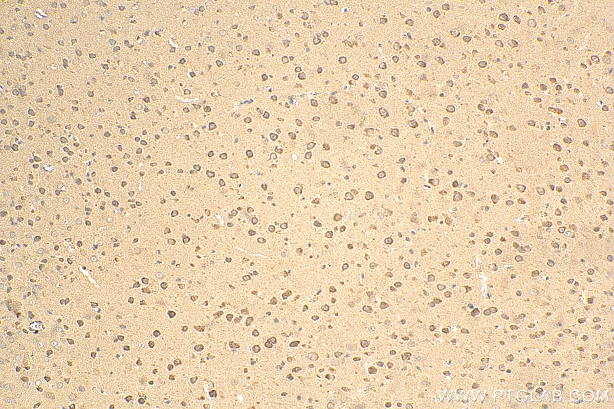 Immunohistochemistry (IHC) staining of mouse brain tissue using EIF2B1 Polyclonal antibody (18010-1-AP)
