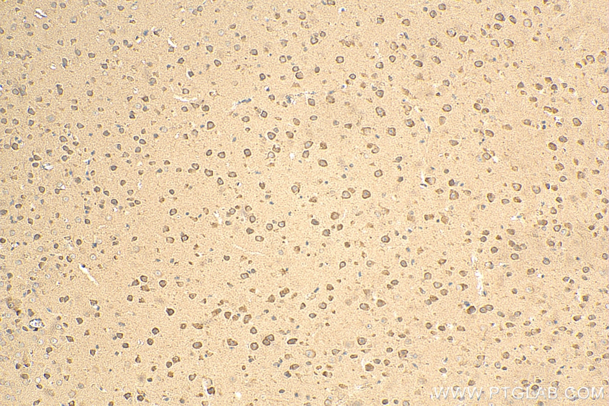 Immunohistochemistry (IHC) staining of mouse brain tissue using EIF2B1 Polyclonal antibody (18010-1-AP)