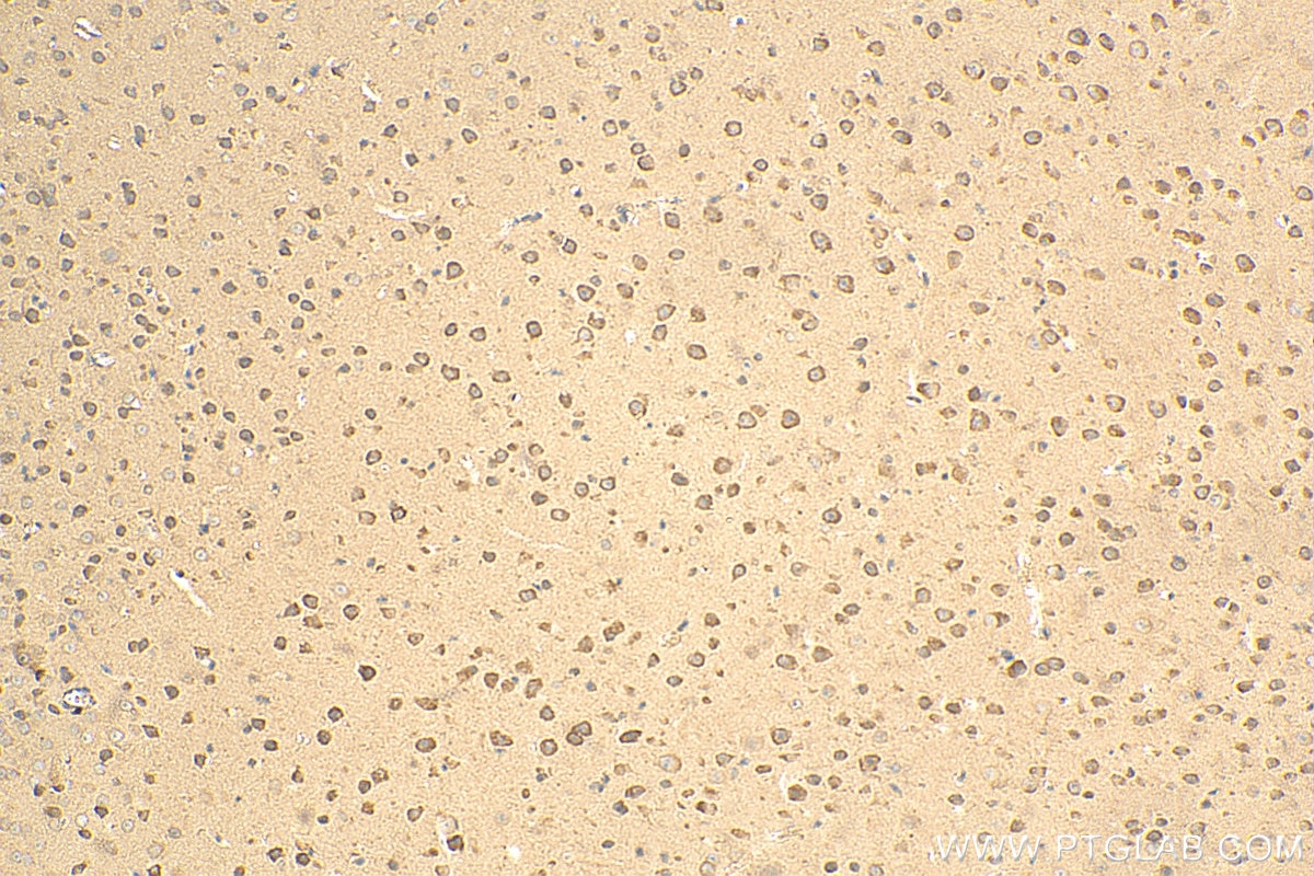 IHC staining of mouse brain using 18010-1-AP