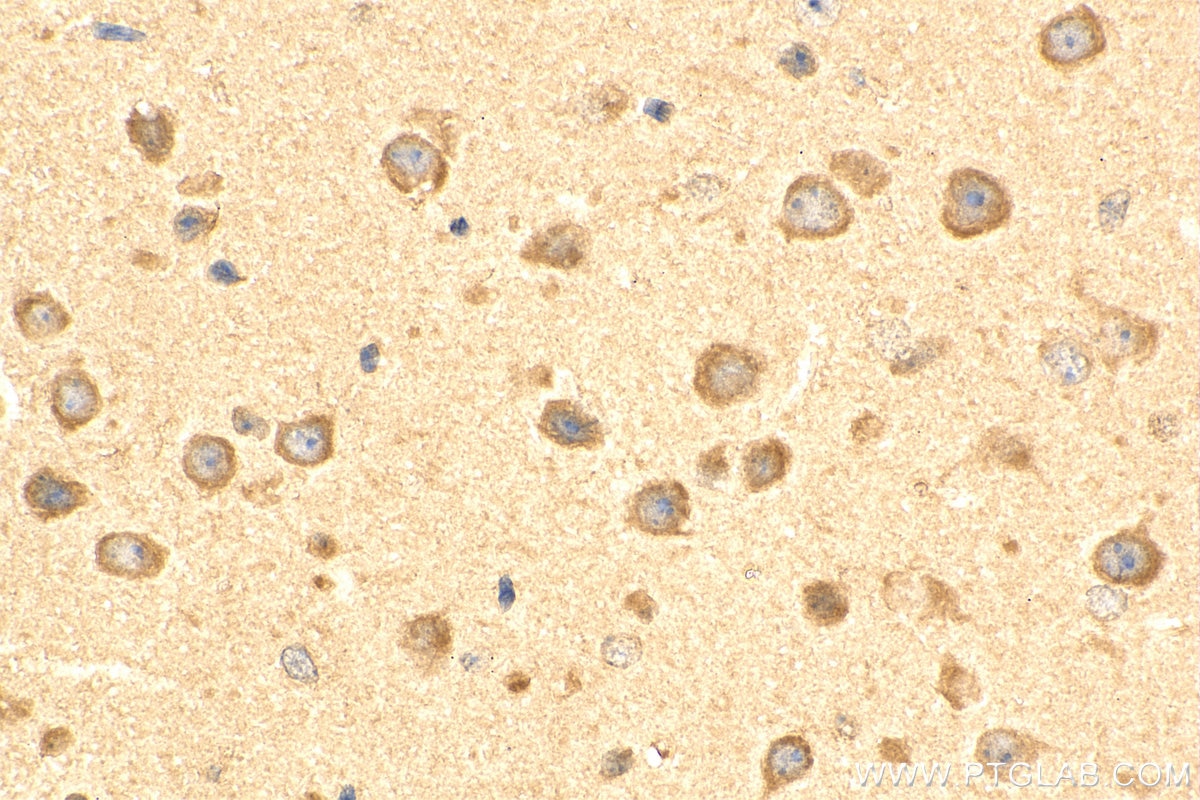 IHC staining of mouse brain using 18010-1-AP