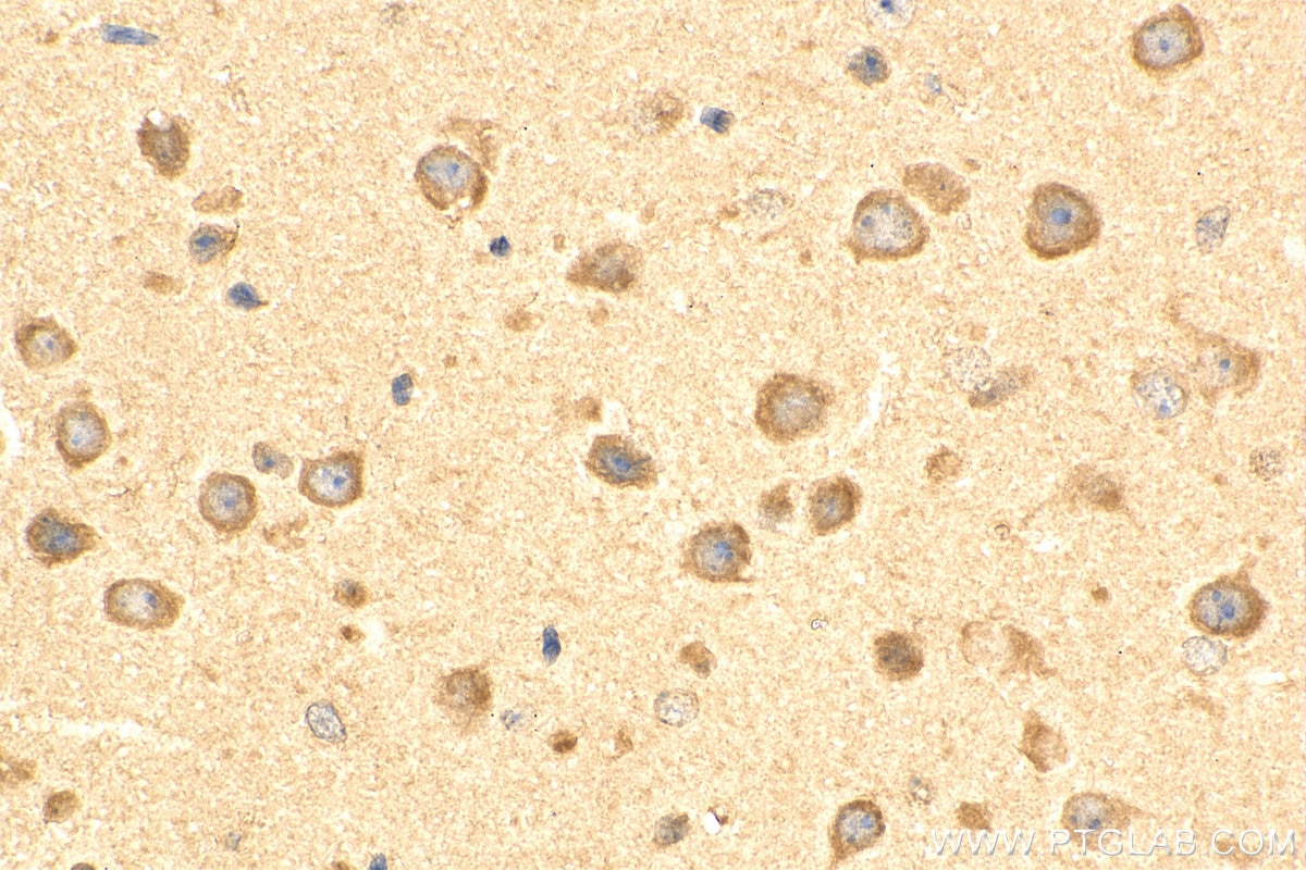 Immunohistochemistry (IHC) staining of mouse brain tissue using EIF2B1 Polyclonal antibody (18010-1-AP)