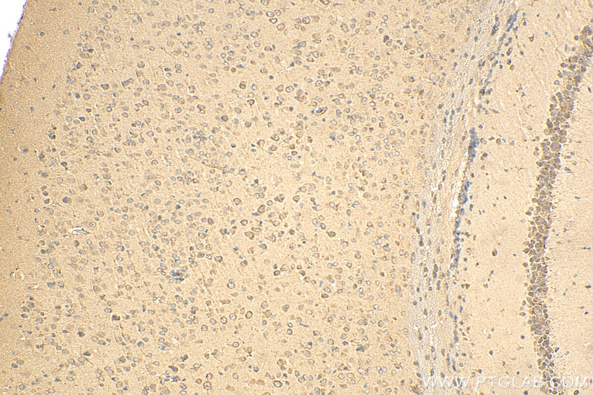 Immunohistochemistry (IHC) staining of mouse brain tissue using EIF2B1 Polyclonal antibody (18010-1-AP)