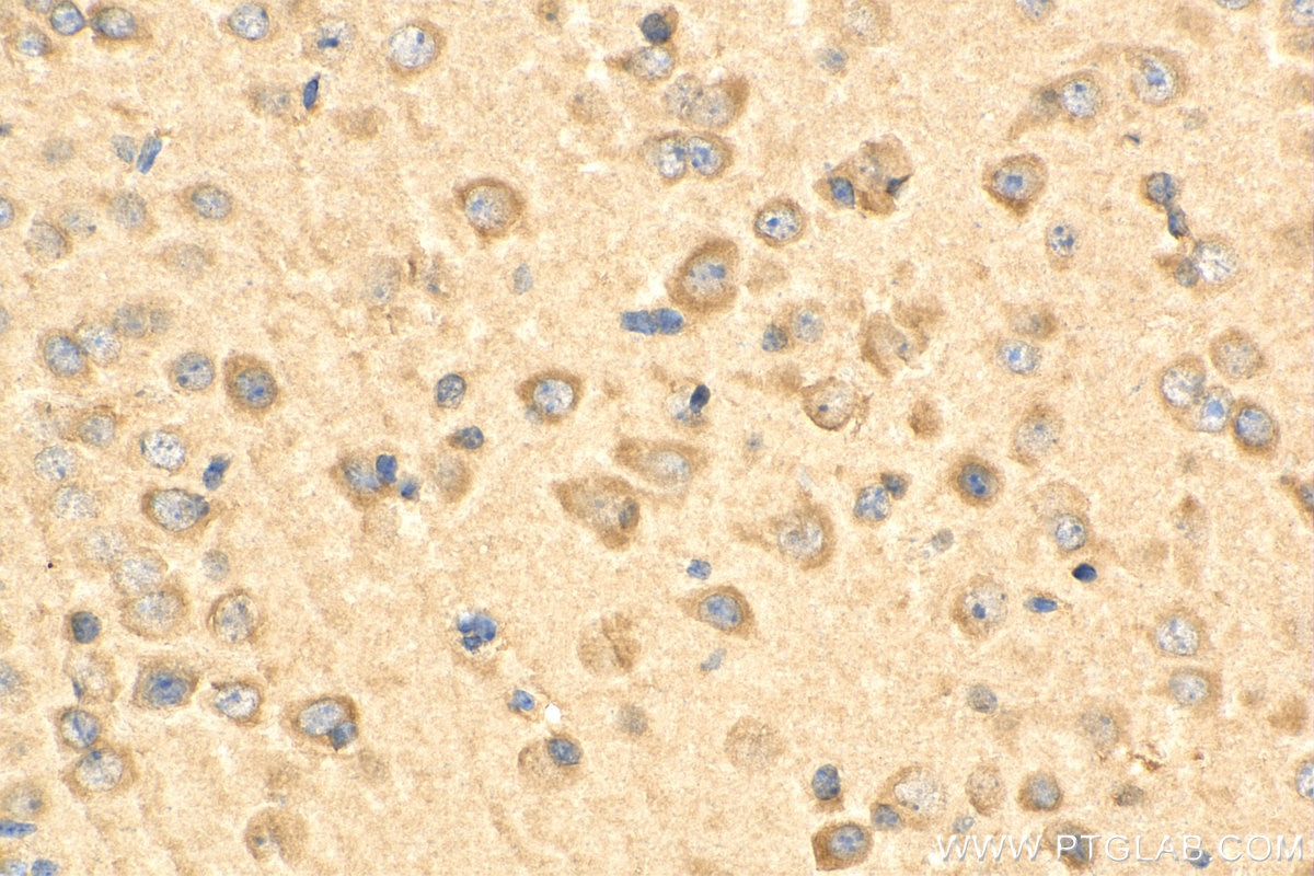 Immunohistochemistry (IHC) staining of mouse brain tissue using EIF2B1 Polyclonal antibody (18010-1-AP)