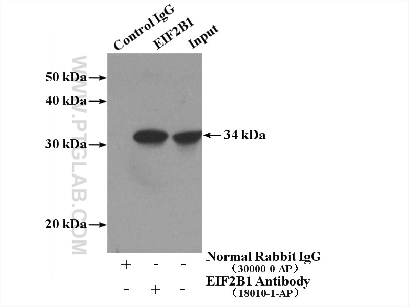Immunoprecipitation (IP) experiment of K-562 cells using EIF2B1 Polyclonal antibody (18010-1-AP)