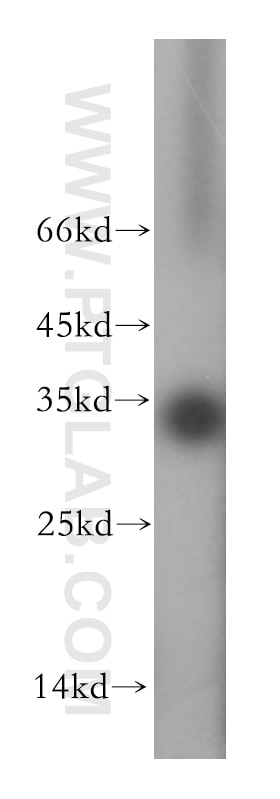 Western Blot (WB) analysis of HeLa cells using EIF2B1 Polyclonal antibody (18010-1-AP)