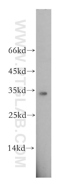 Western Blot (WB) analysis of MCF-7 cells using EIF2B1 Polyclonal antibody (18010-1-AP)