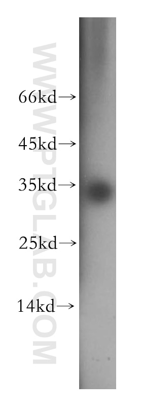 Western Blot (WB) analysis of K-562 cells using EIF2B1 Polyclonal antibody (18010-1-AP)