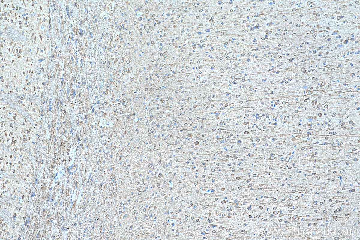 Immunohistochemistry (IHC) staining of rat brain tissue using EIF2B2 Polyclonal antibody (11034-1-AP)