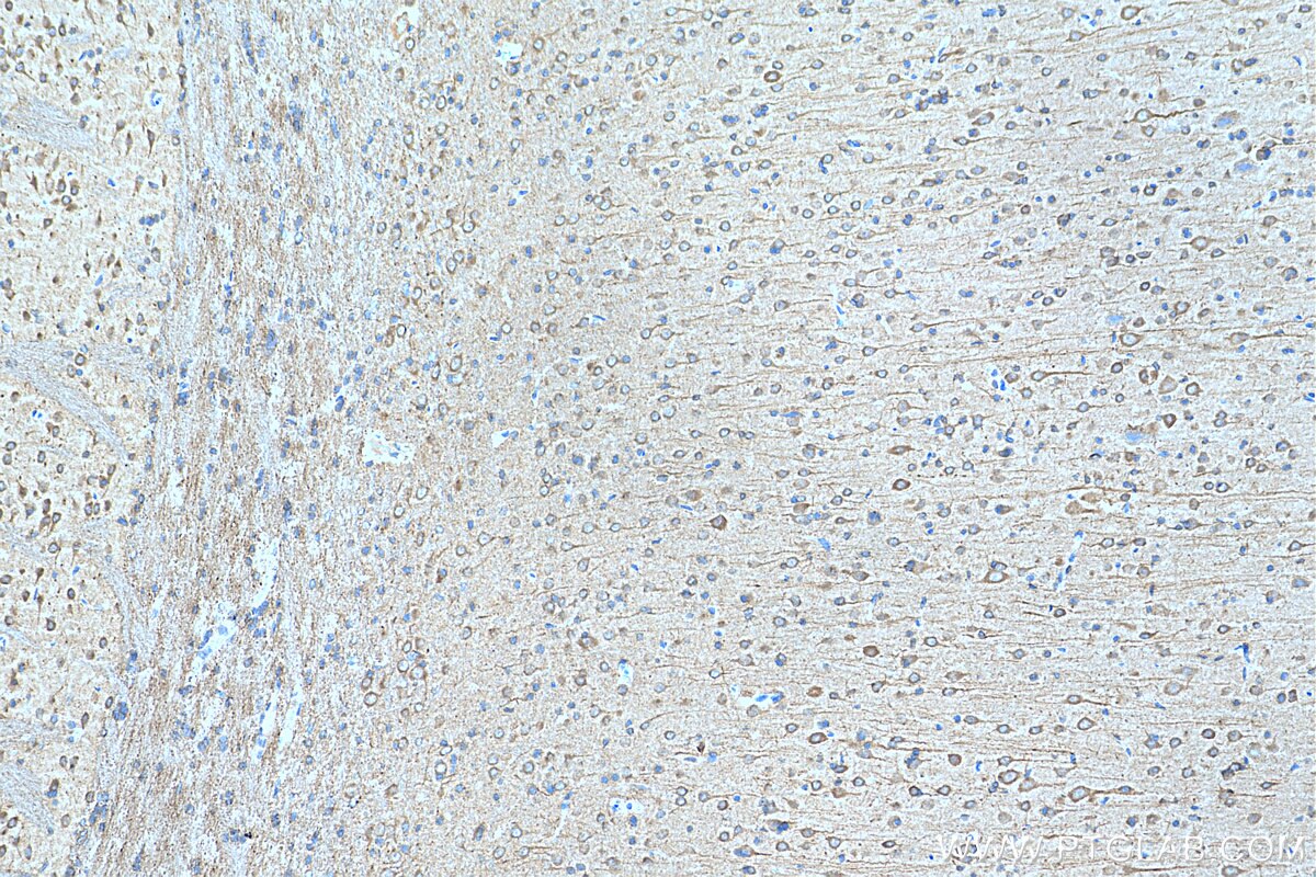 IHC staining of rat brain using 11034-1-AP