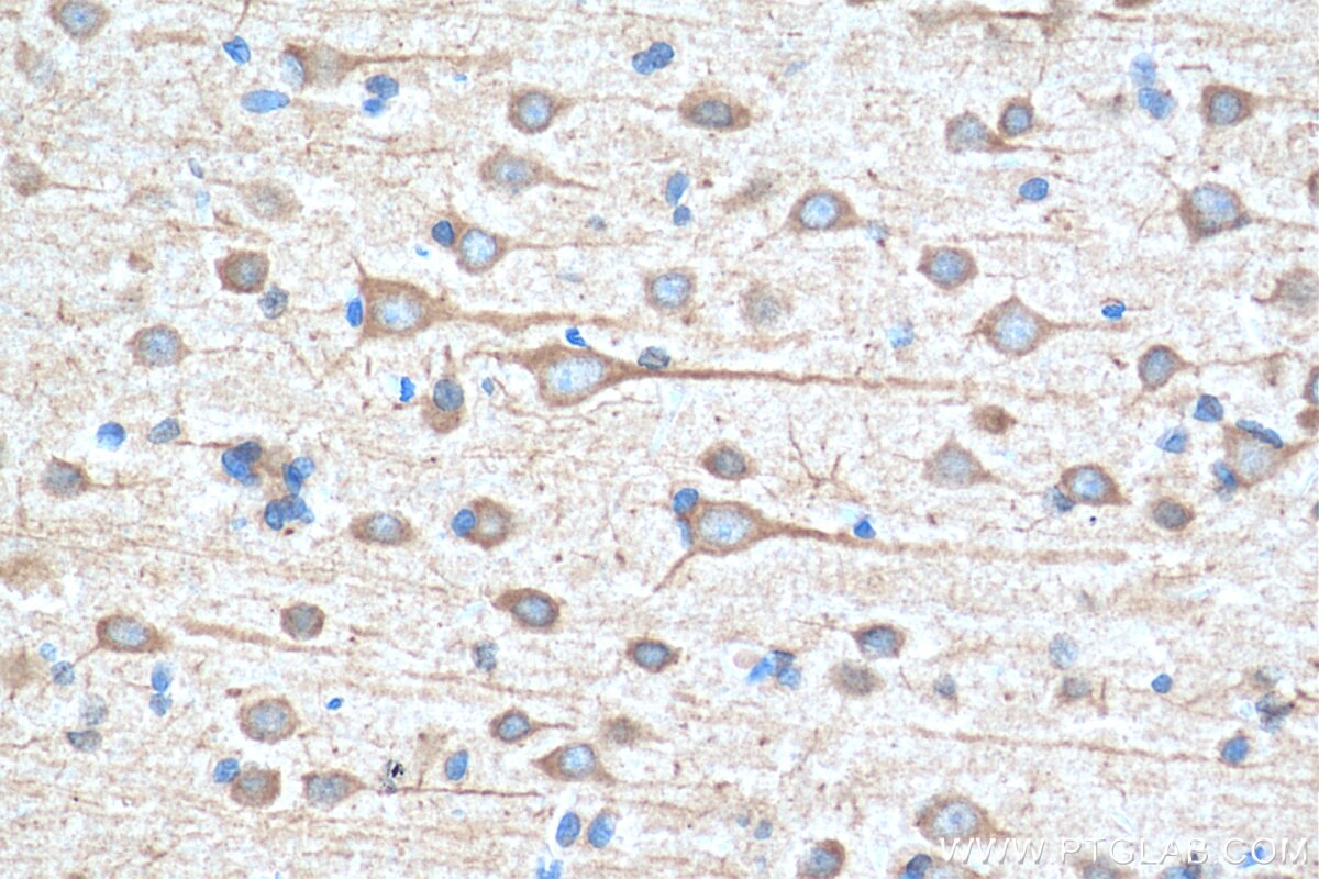 Immunohistochemistry (IHC) staining of rat brain tissue using EIF2B2 Polyclonal antibody (11034-1-AP)