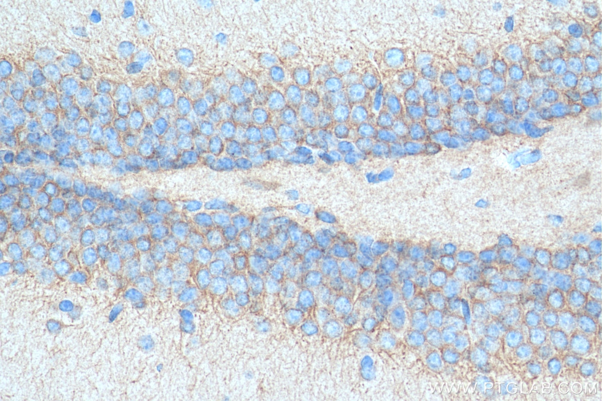 Immunohistochemistry (IHC) staining of mouse brain tissue using EIF2B2 Polyclonal antibody (11034-1-AP)