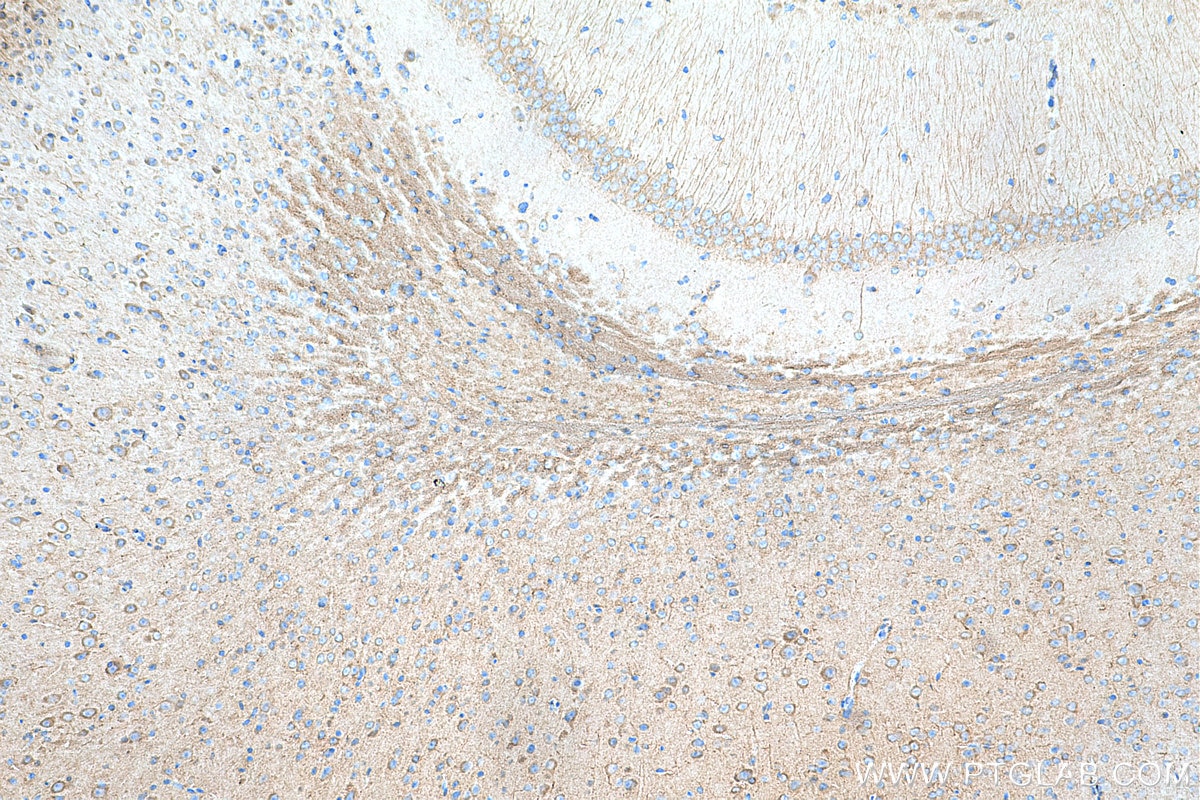 Immunohistochemistry (IHC) staining of mouse brain tissue using EIF2B2 Polyclonal antibody (11034-1-AP)