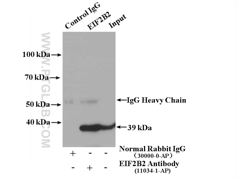 Immunoprecipitation (IP) experiment of HEK-293 cells using EIF2B2 Polyclonal antibody (11034-1-AP)