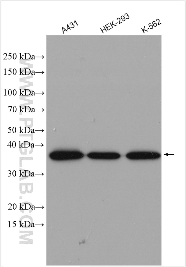 Western Blot (WB) analysis of various lysates using EIF2B2 Polyclonal antibody (11034-1-AP)