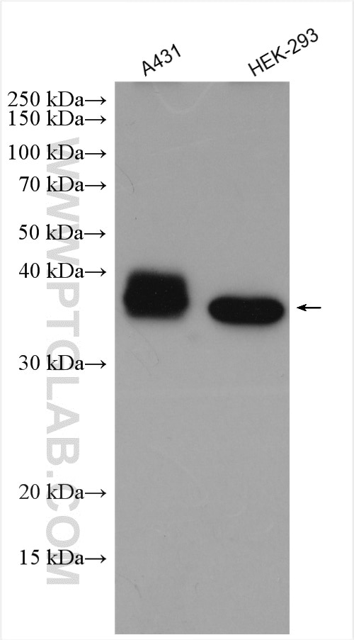 Western Blot (WB) analysis of various lysates using EIF2B2 Polyclonal antibody (11034-1-AP)