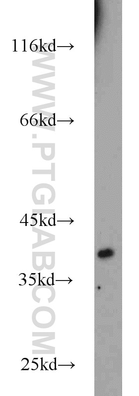 Western Blot (WB) analysis of mouse liver tissue using EIF2B2 Polyclonal antibody (11034-1-AP)