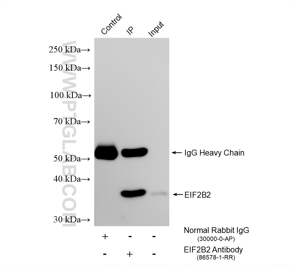 Immunoprecipitation (IP) experiment of A431 cells using EIF2B2 Recombinant monoclonal antibody (86578-1-RR)
