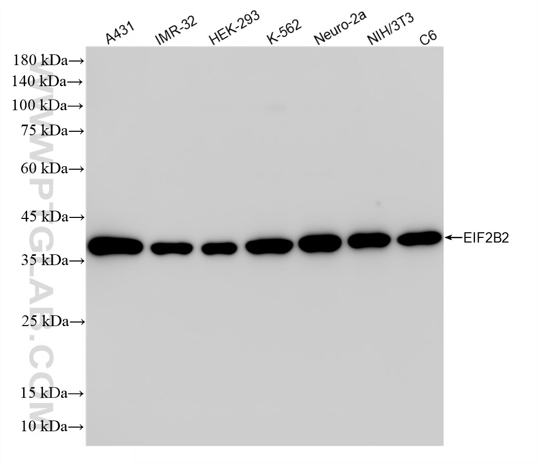 Western Blot (WB) analysis of various lysates using EIF2B2 Recombinant antibody (86578-1-RR)
