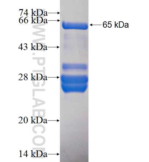 EIF2B2 fusion protein Ag1502 SDS-PAGE