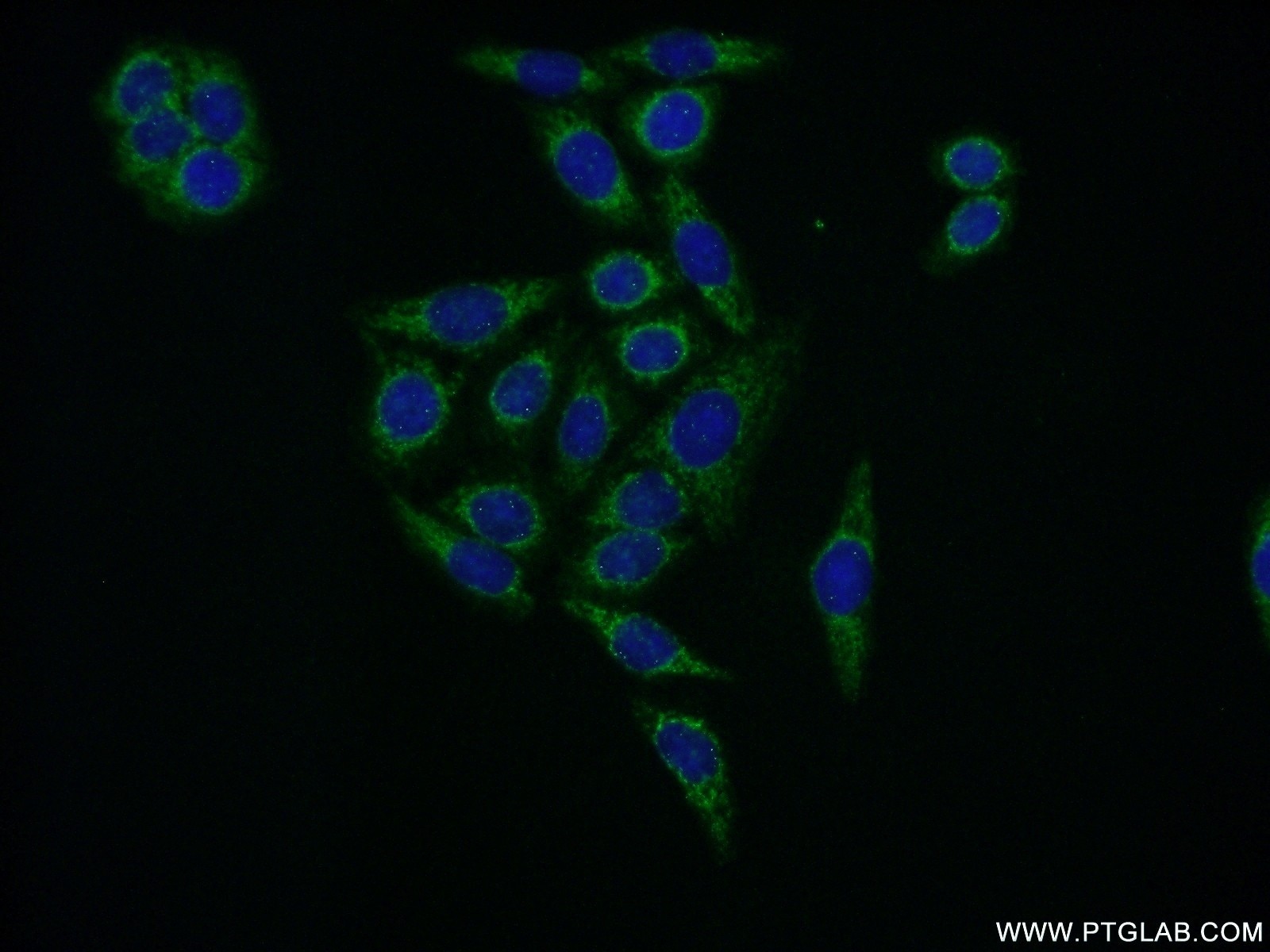 Immunofluorescence (IF) / fluorescent staining of HeLa cells using EIF2B3 Polyclonal antibody (11296-2-AP)
