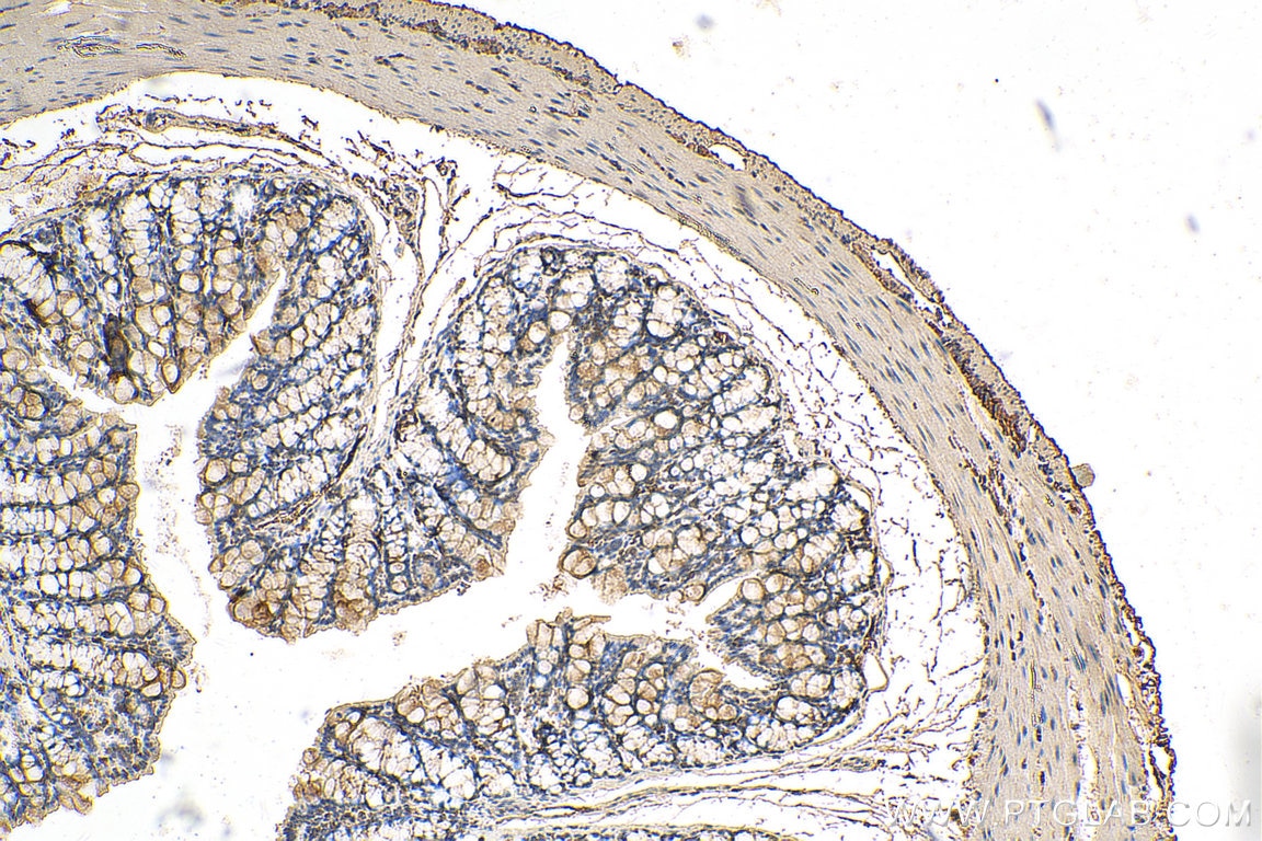 IHC staining of mouse colon using 11296-2-AP