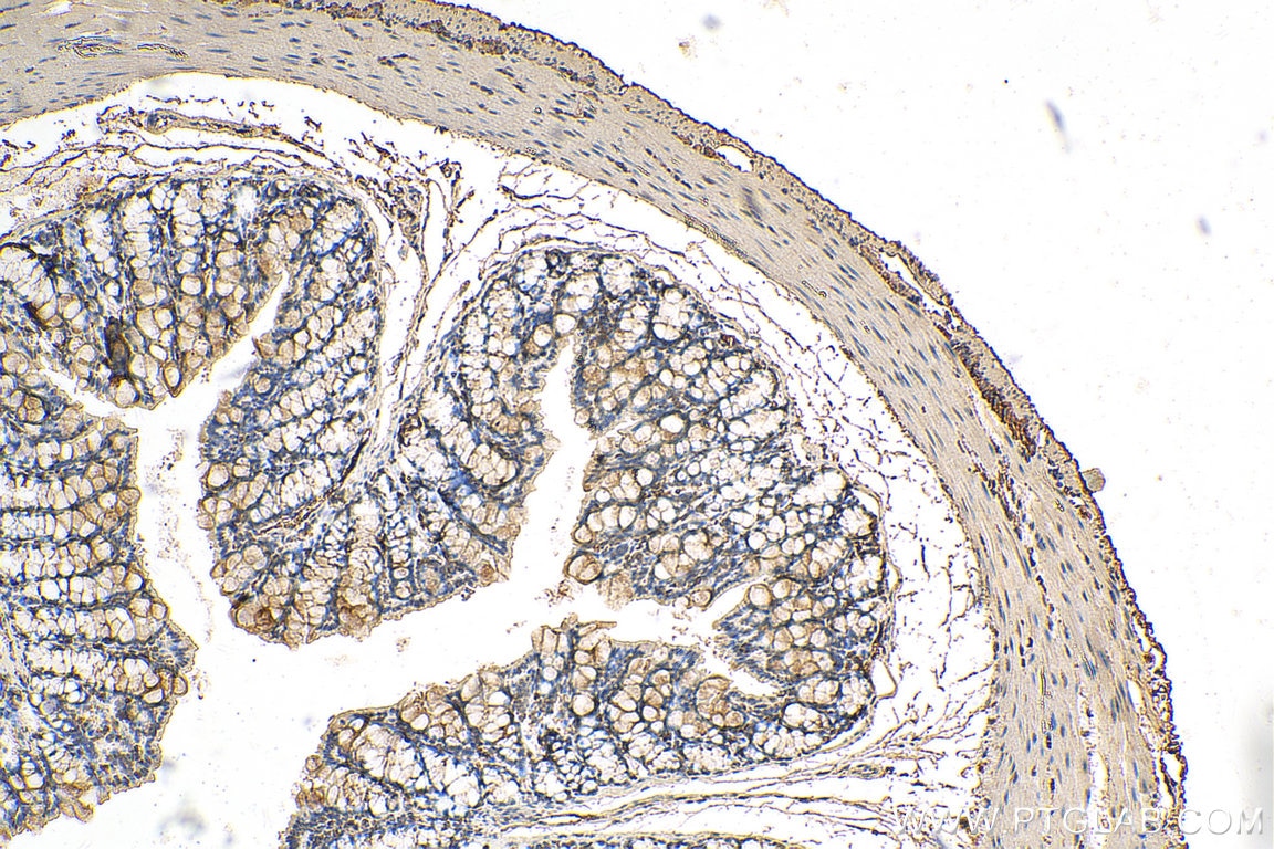 Immunohistochemistry (IHC) staining of mouse colon tissue using EIF2B3 Polyclonal antibody (11296-2-AP)