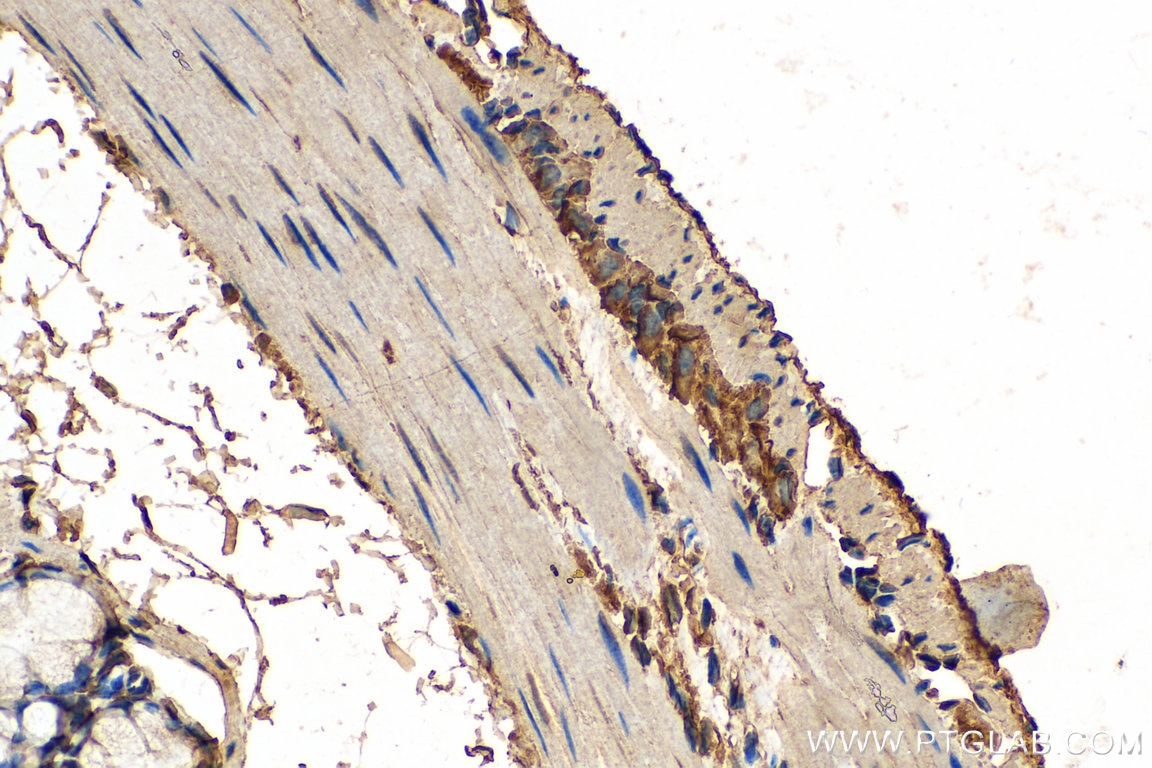 Immunohistochemistry (IHC) staining of mouse colon tissue using EIF2B3 Polyclonal antibody (11296-2-AP)
