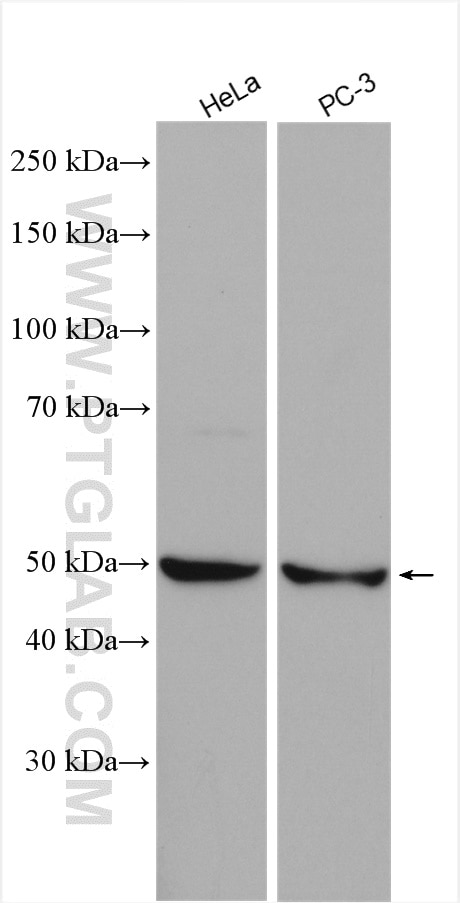 Western Blot (WB) analysis of various lysates using EIF2B3 Polyclonal antibody (11296-2-AP)