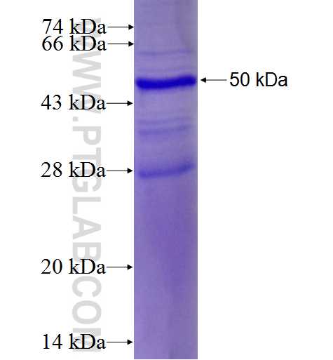 EIF2B3 fusion protein Ag1809 SDS-PAGE