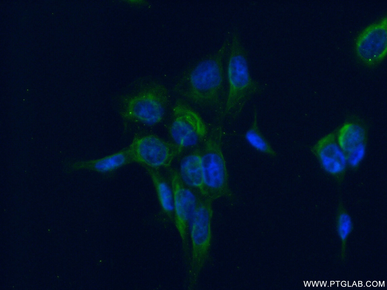 Immunofluorescence (IF) / fluorescent staining of MCF-7 cells using EIF2B4 Polyclonal antibody (11332-1-AP)